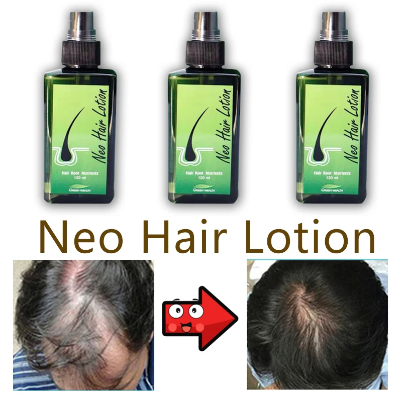 

Neo Hair Lotion Original Hair Growth Treatment for Men Women Thailand Hair Root Anti-Loss Beard Regrowth Hair Care Beauty Health