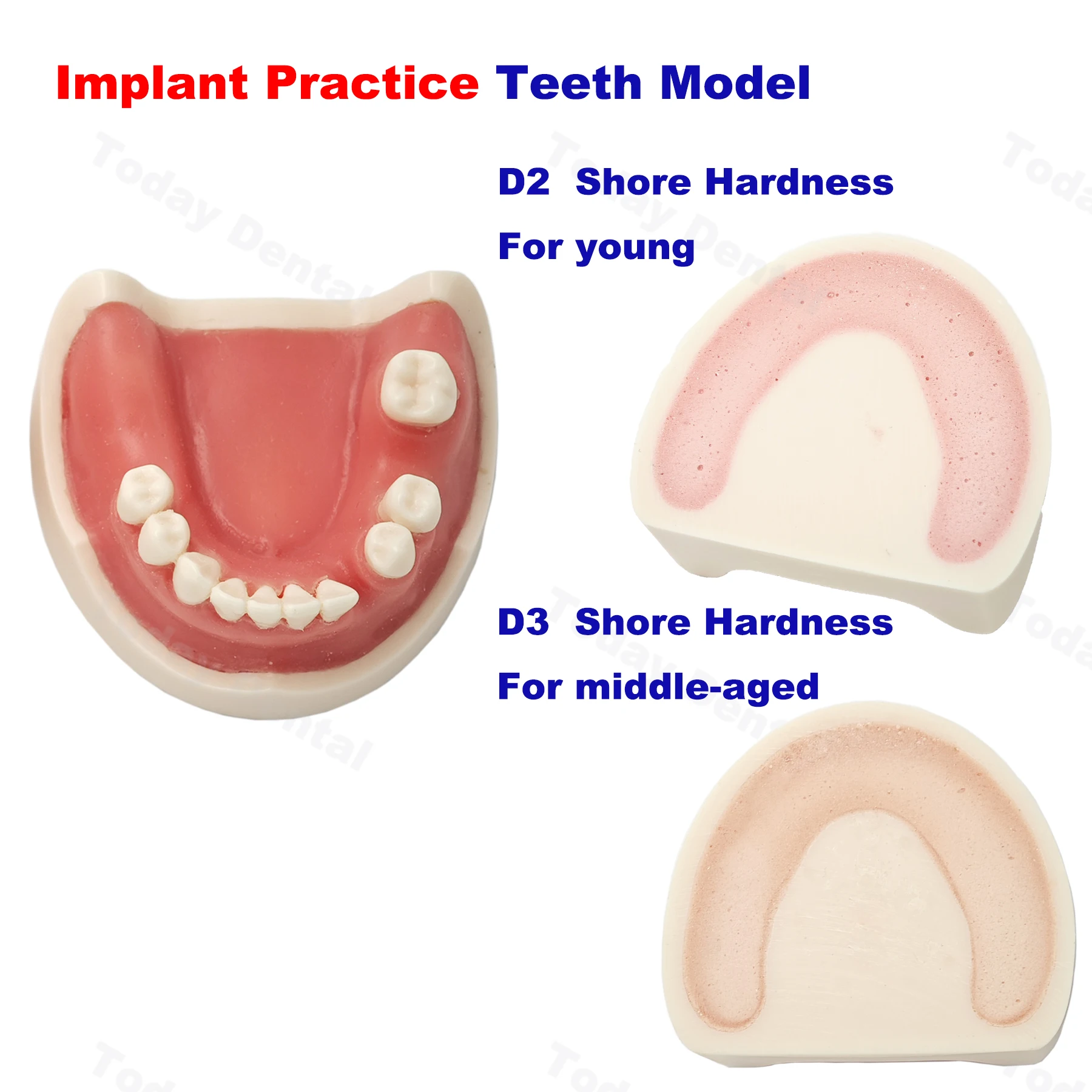 Зубной имплантат модель зубов тренировочная для дантиста Студенческая