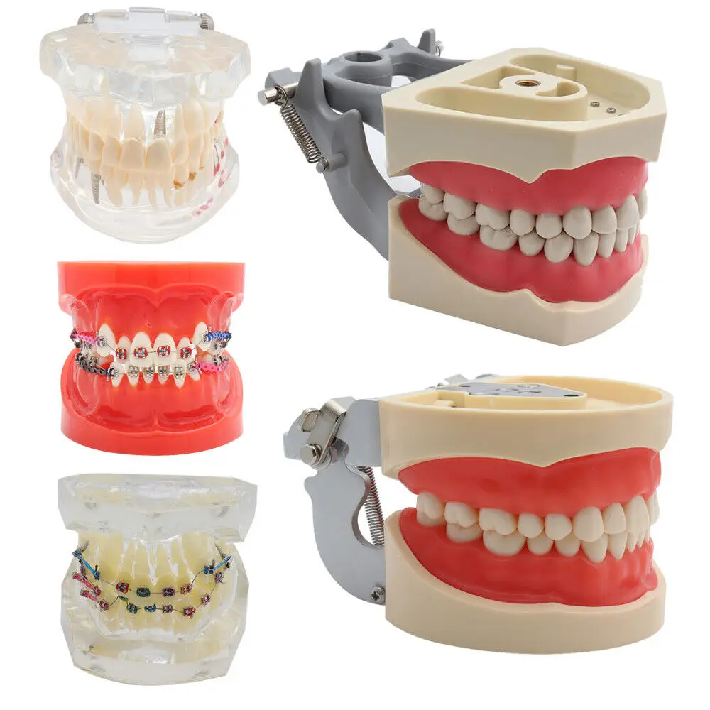 Dentalmall Dental Standard Teeth Model Orthodontic Model Implant and Restoration Model