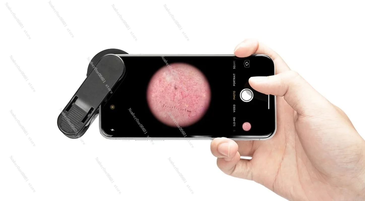 Портативный дерматоскоп увеличительное стекло поляризационный и