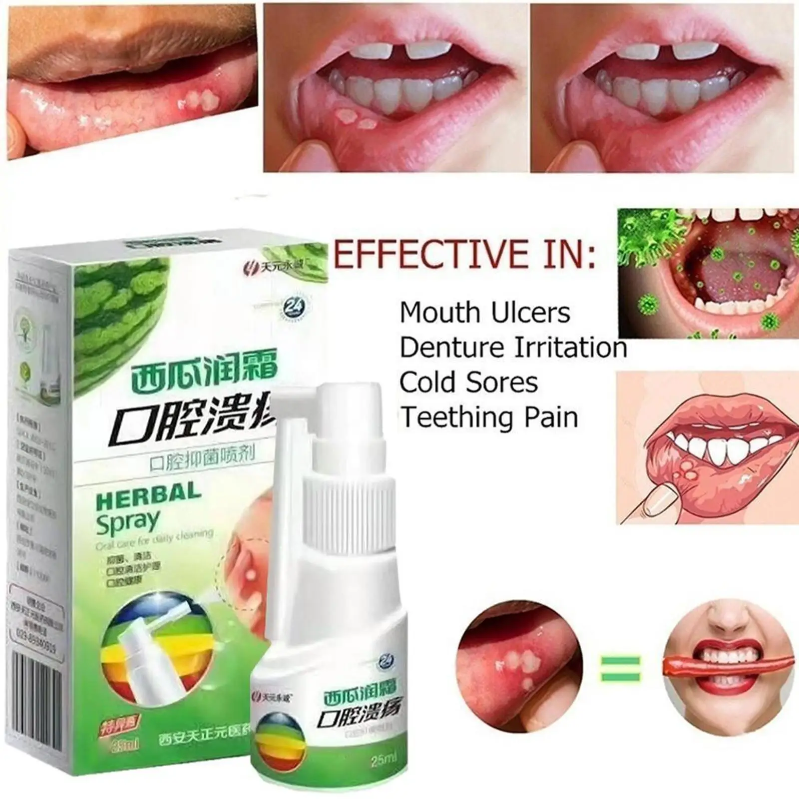 

Антибактериальный спрей для облегчения боли, 25 мл