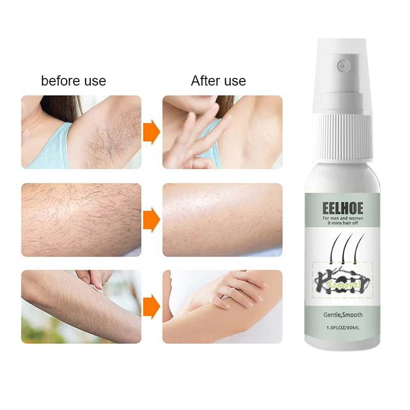 

Eelhoe 30ml Hair Removal Spray Cream Under Armpit Chest Mild Hair Removal Does Not Stimulate For Men And Women Beauty Health