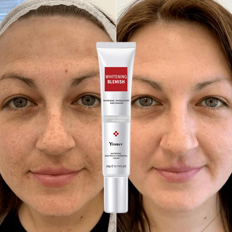 

Whitening Freckle Cream Effective Remove Melasma Serum Fade Dark Spots Melanin Moisturize Brighten Smooth Face Skin Care Beauty