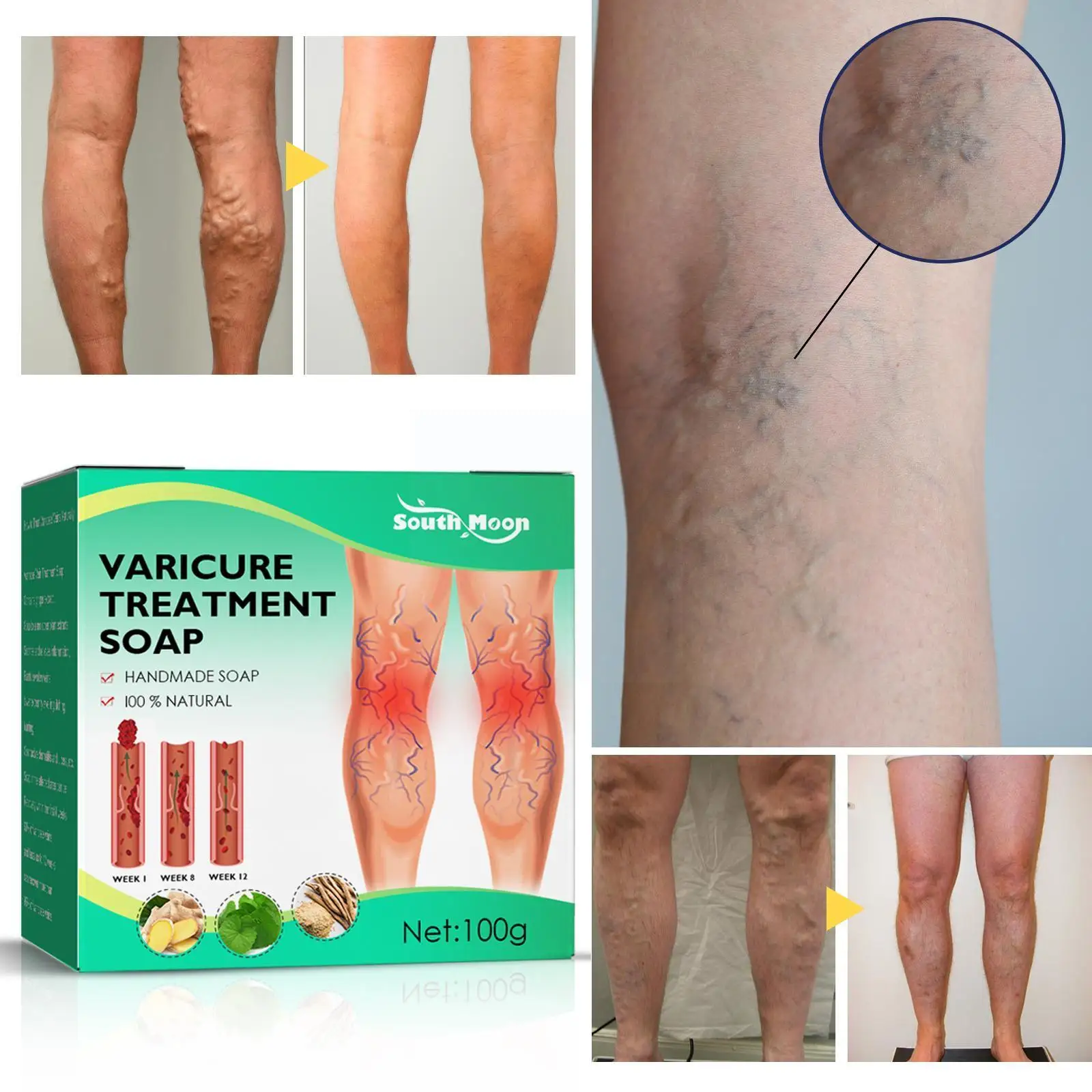 

Мыло для лечения варикозного расширения вен, 100 г