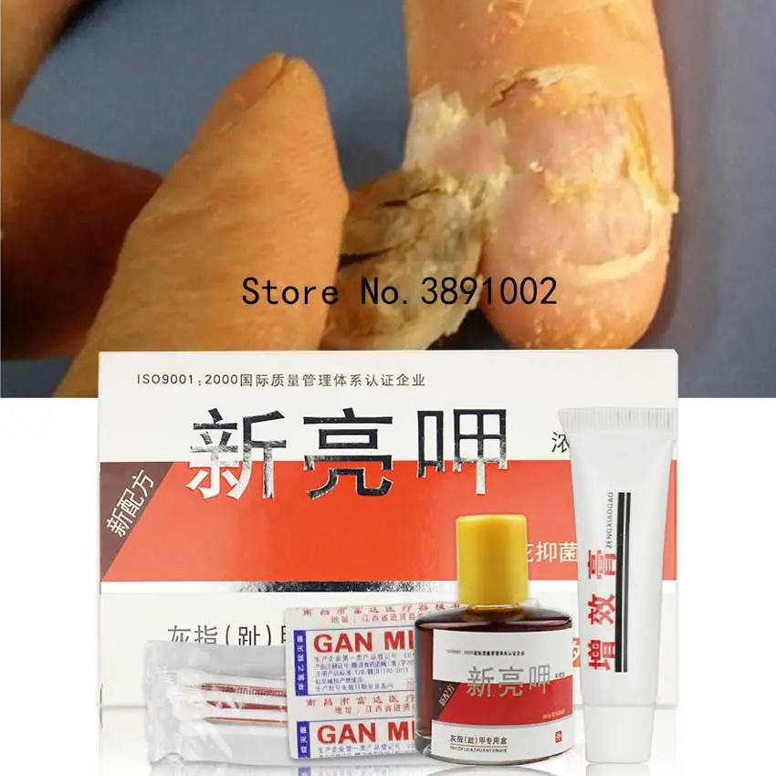 

Травяная эссенция для лечения Ногтей от грибков, эссенция для лечения Ногтей на пальцах ногтей, против грибка, Лечение ногтей, лосьон для ух...