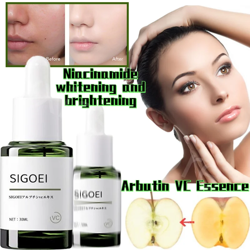 

SIGOEI Arbutin VC Essence Liquid Brightens Skin Tone Niacinamide Liquid Replenishes Moisture Whitening and Removes Dark Yellow