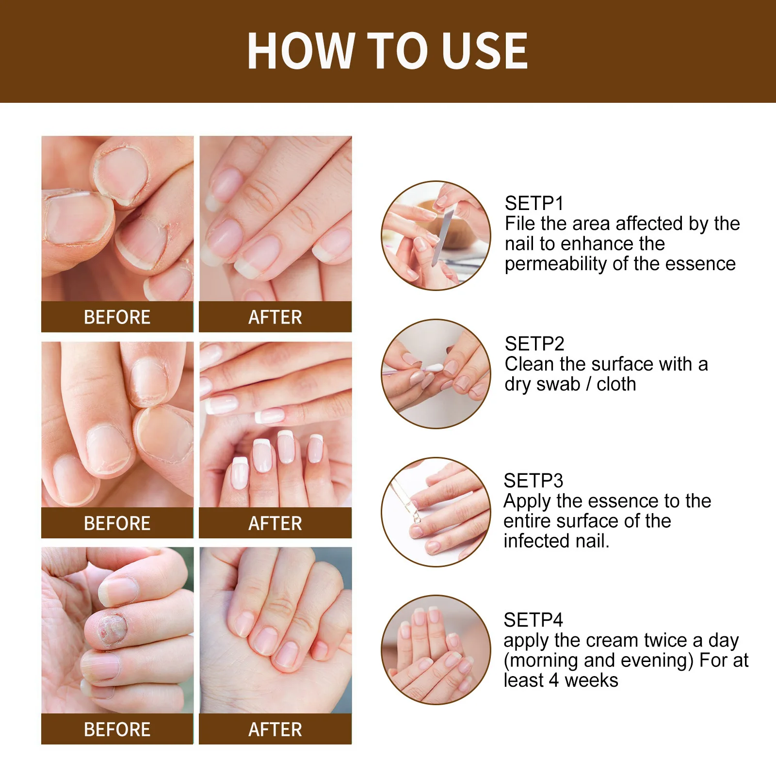 Органическая сыворотка для роста ногтей восстанавливающая ногти рук и ног рот на