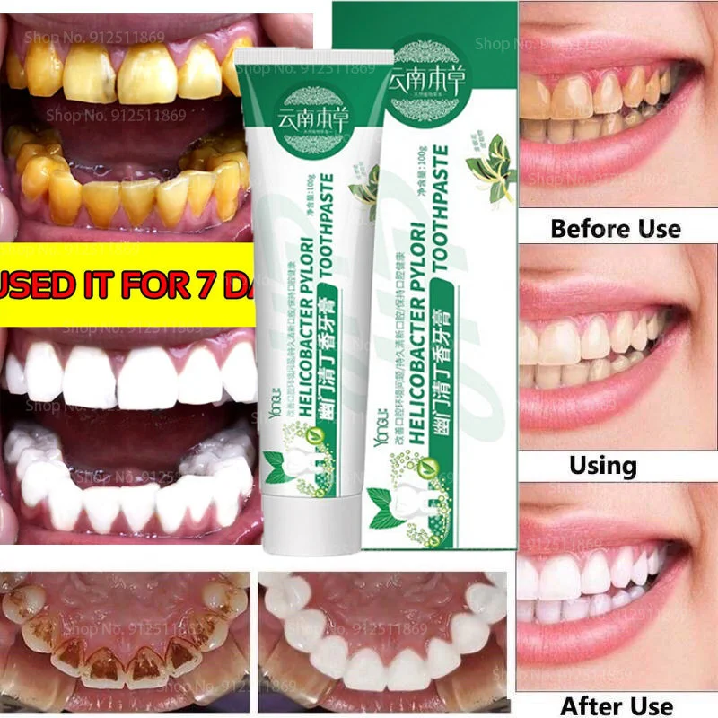 

New Herbal Cloves Foam Toothpaste Teeth Whitening Stain Removal Mouth Breathing Freshener Tooth Cleaning Care Toothpaste 100g