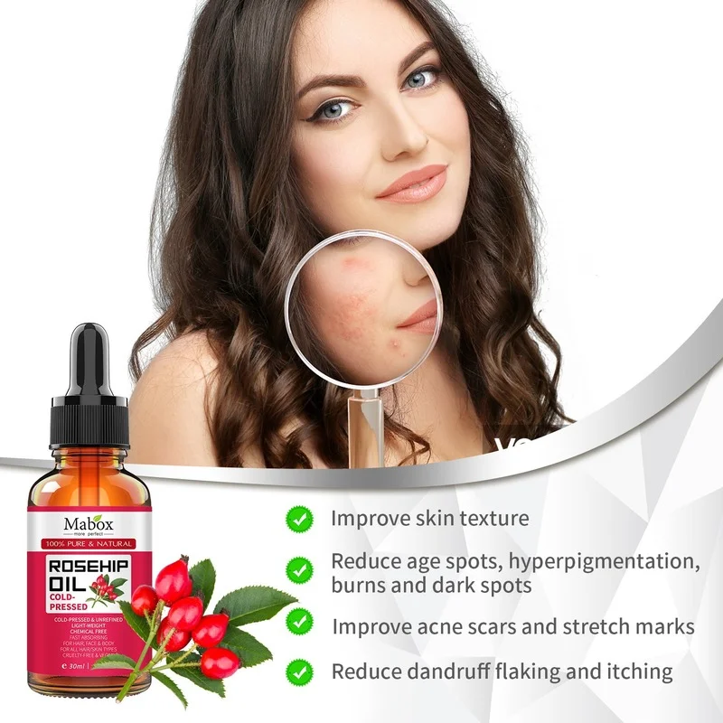 

Pure Rosehip Oil Organic Moisturizer to Heal Dry Skin Anti Aging Essential Oil Reduce Acne Scars Fineline Wrinkle Stretch Mark