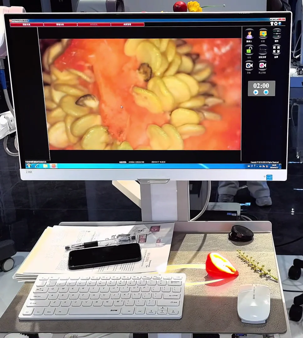 Kernel KN-2200BI Медицинское цифровое электронное видео по хорошей цене для гинекологии