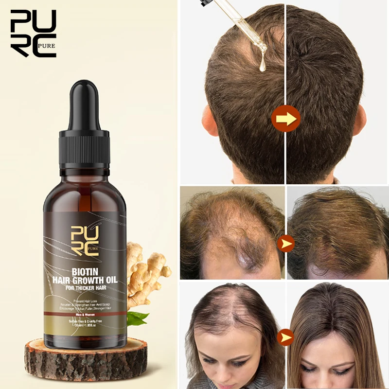 

Продукты для роста волос PURC Biotin для мужчин и женщин, имбирное средство для лечения выпадения волос, эфирное масло для ухода за волосами, масло для бороды