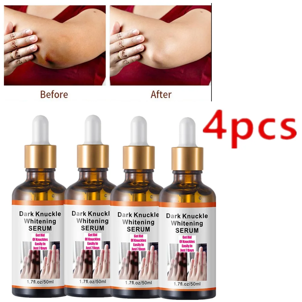 

4PCS Get Rid Of Dark Knuckles In 7 Days Serum Whitening Removing Dark knuckles Serum Hand knuckle Eraser Serum for Elbow and Kne