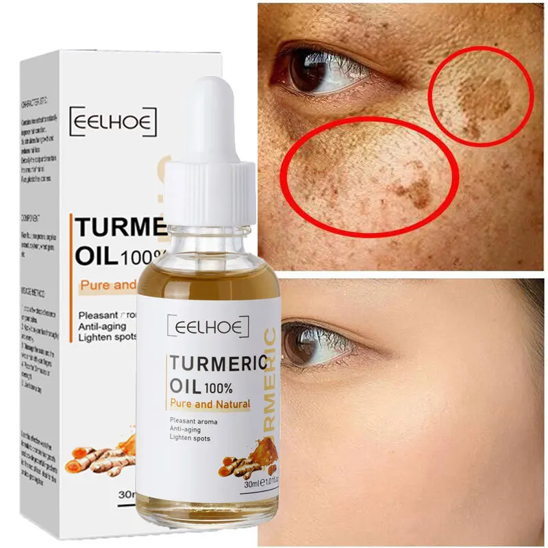 

Turmeric Serum Whitening Freckle Dark Spots Organic Turmeric Oil Brighten Dark Skin Pigmentation Anti Aging Anti Wrinkle Essence