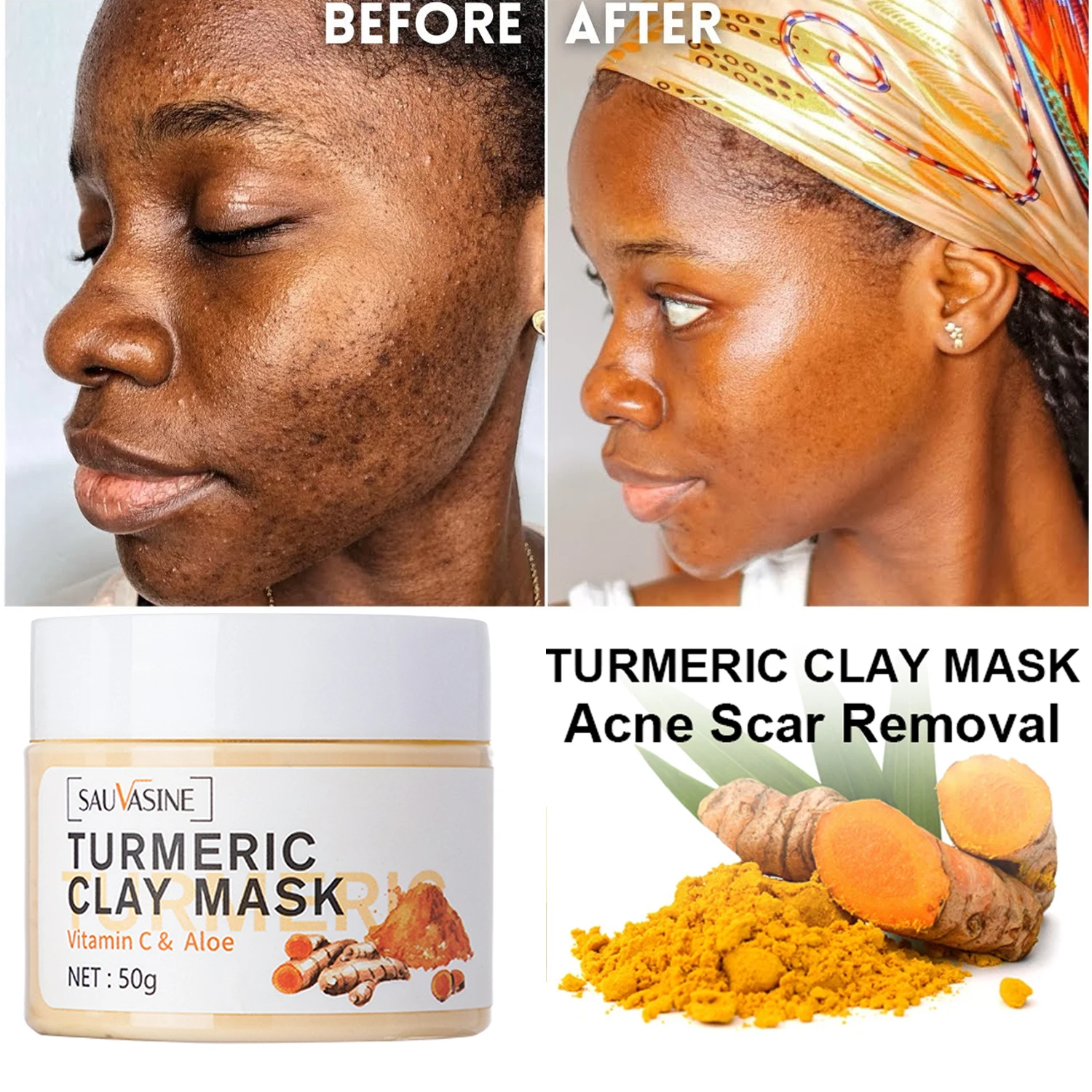 

Turmeric Vitamin C Face Mask Whitening Freckles Remove Dark Spots Melasma Oil Control Deep Cleansing Anti Acne Face Skin Care