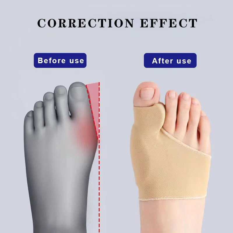 2Pcs Toe Separators Hallux Valgus Bunion Corrector Orthotics Feet Bone Thumb Adjuster Deformity Correction Sock Straightener