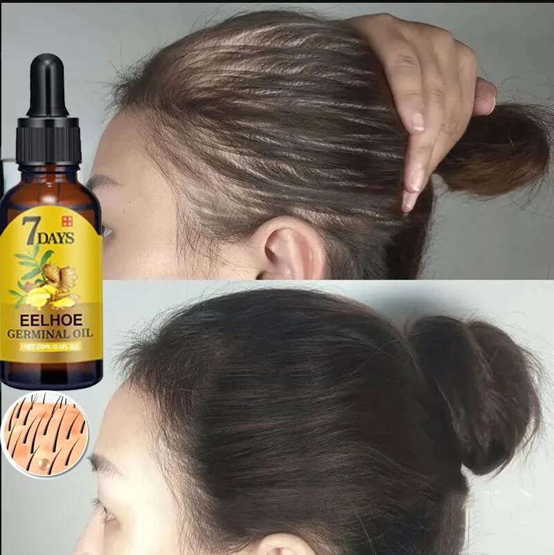 

Имбирный спрей для роста волос, средство против выпадения волос, эфирное масло, средство против облысения, жидкое лечение кожи головы, Восстанавливающий уход за поврежденными волосами