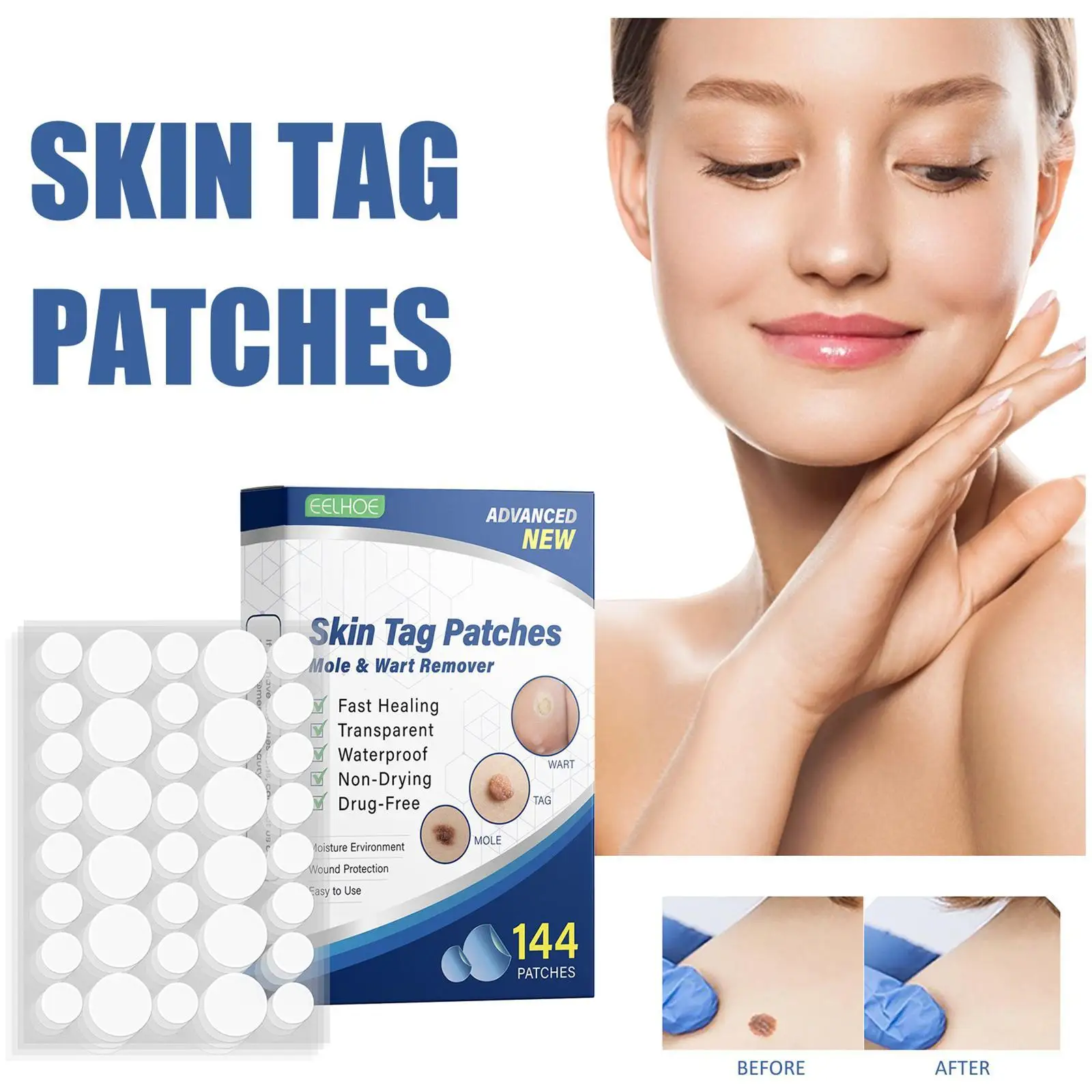 

144Pcs Skin Tag Patch Mole Wart Remover Acne Warts Waterproof Fast Healing Invisible Stickers Skin Tag Warts Treatment Skin Care