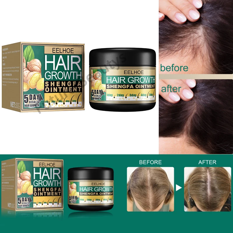 

EELHOE 30ml Moroccan Hair Growth Repair Cream with Ginger Oil Hair Growth Treatment Anti-Hair Loss Products Scalp Care