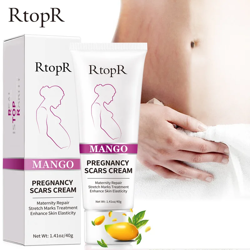 

Mango Remove Pregnancy Scars Acne Cream Stretch Marks Treatment Maternity Repair Anti-Aging Anti-Winkles Firming Body Creams