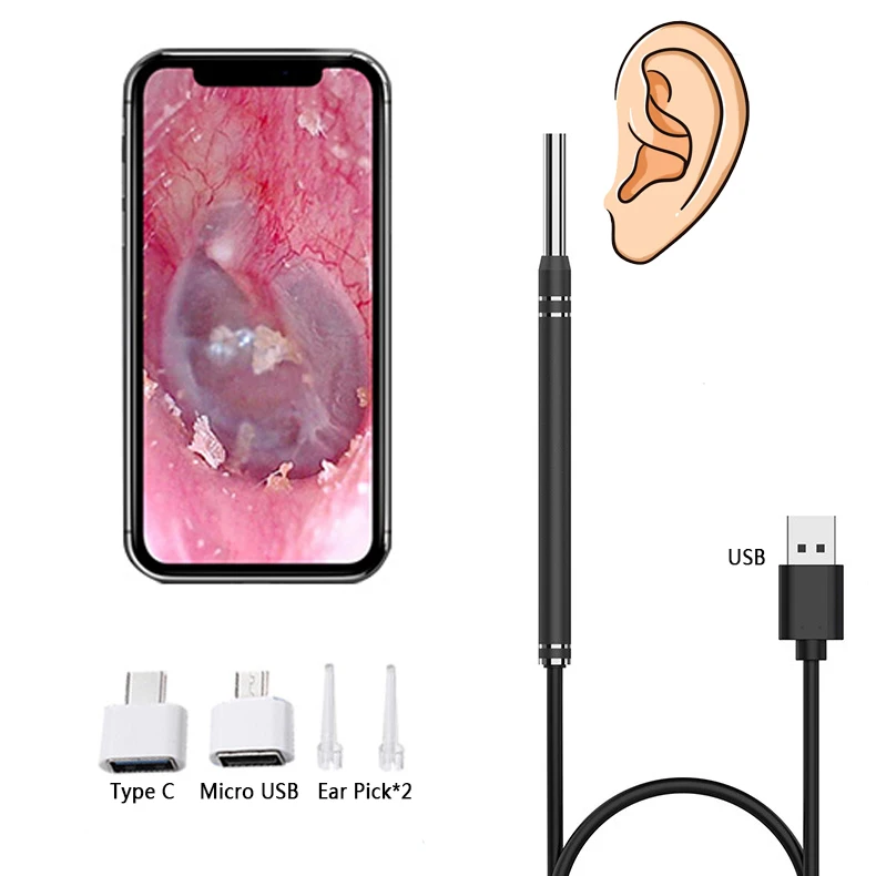 

Smart Visual Ear Cleaner Ear Stick Endoscope Earpick Camera Otoscope Ear Cleaner Ear Wax Remover Ear Picker Earwax Removal Tool