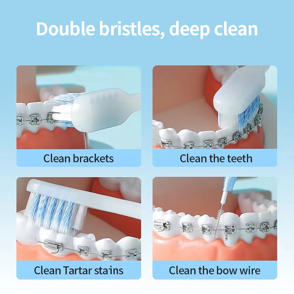 5 шт. Ортодонтические зубные щётки с V-образной щетиной