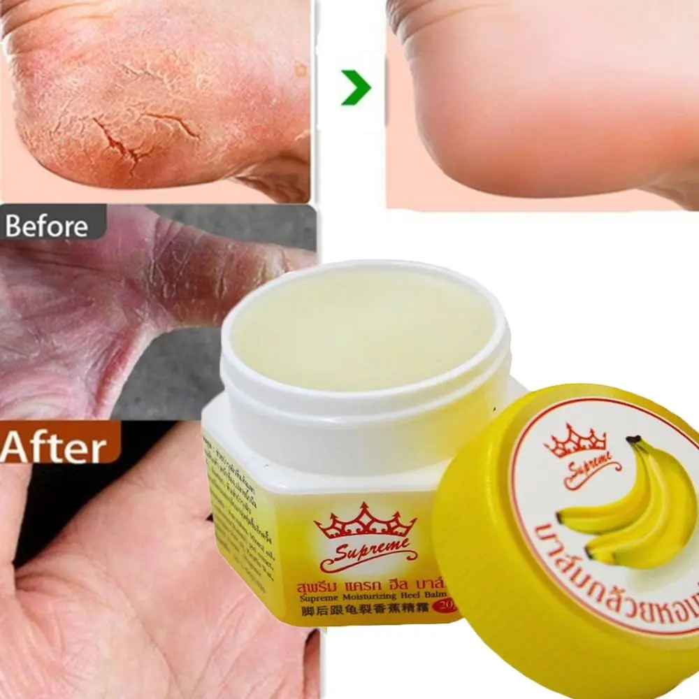 

Nourish Anti Chapped Anti Fungal Banana Oil Repair Skin Care Product Dead Skin Remover Anti-Drying Crack Cream