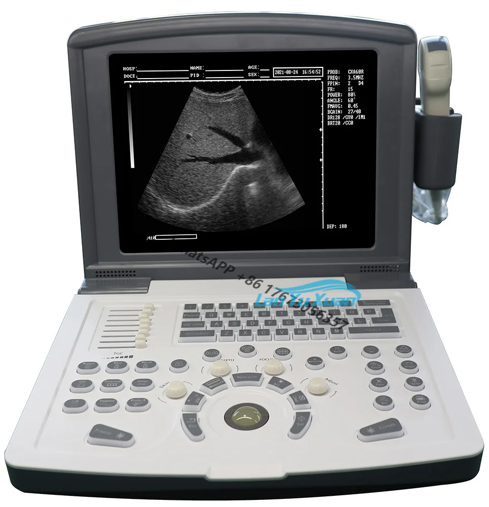 

RUIHUA Manufacturer Small and Portable Ultrasound Machine