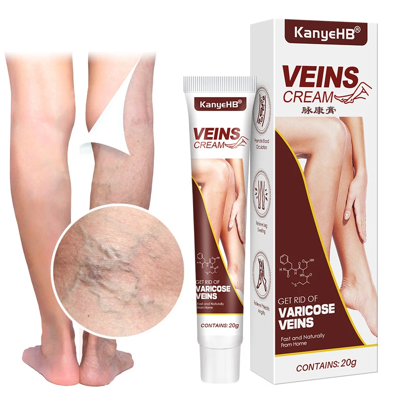 

Soothing Relieve Pain Herbal Ointment Effective Varicose Vein Relief Cream Eliminate Vasculitis Phlebitis Spider Legs Treatment
