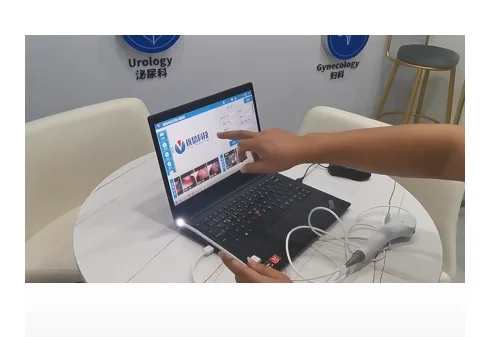 

BESDATA USB-нософарригоскоп BR-D1/BR-D2/BR-D3/BR-D4