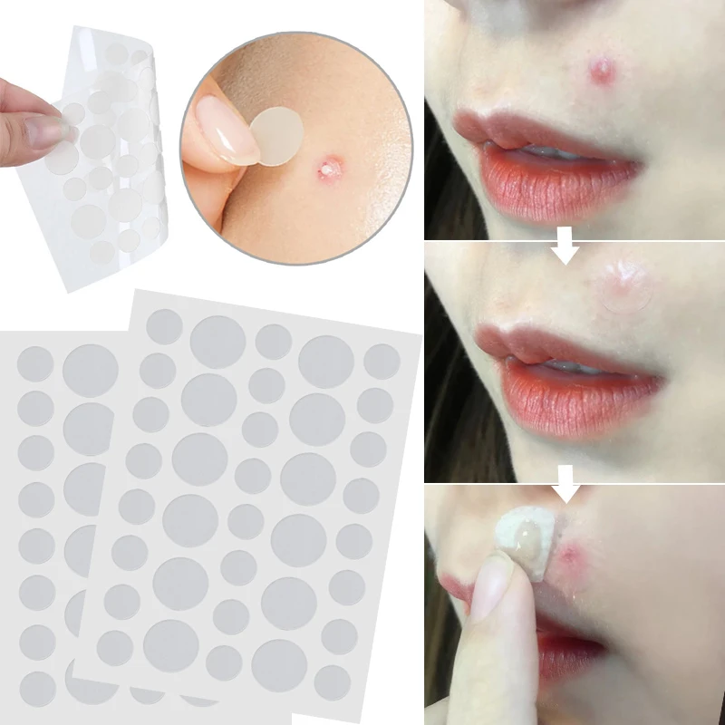 36 шт./лист прозрачные невидимые Патчи от акне этикетки для удаления прыщей