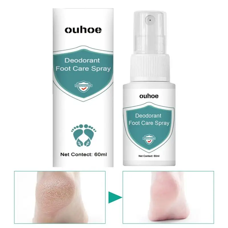 

60 мл натуральный дезодорант-спрей для ног средство для удаления запаха пота на ногах средство для ухода за кожей стоп дезодорант для ног спрей от зуда