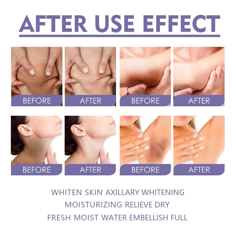 Крем для быстрого отбеливания темной кожи