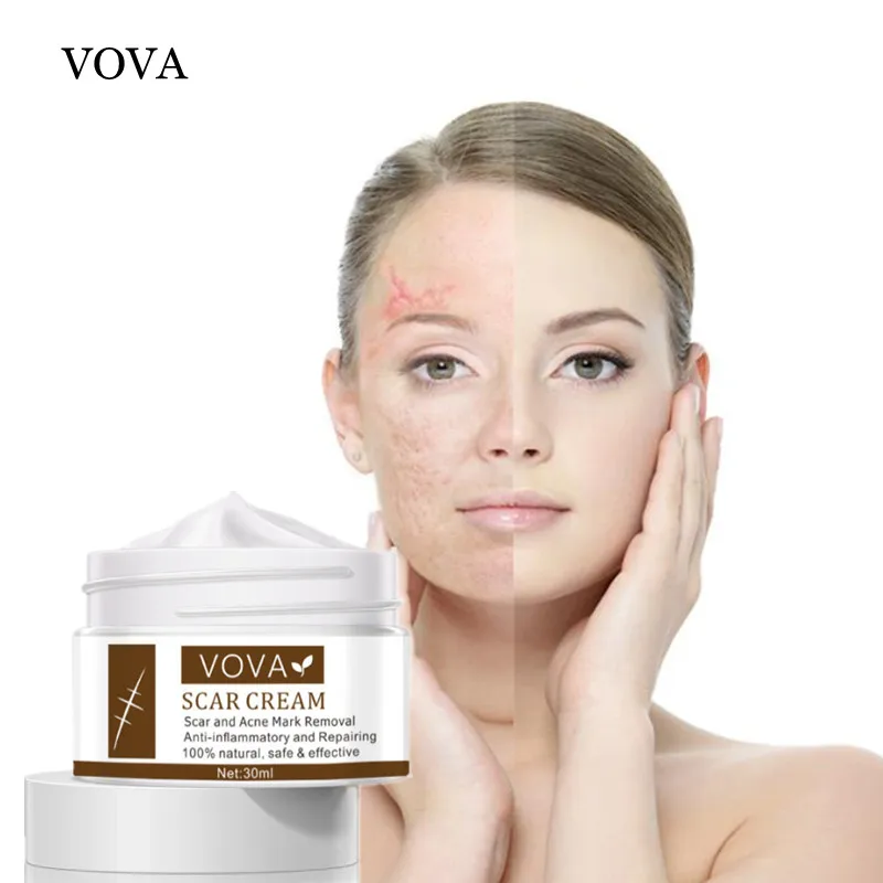 

VOVA Scar Removal Cream Removes Scars Stretch Marks Repairs and Smoothes Skin for Face & Body Skin Care 30ml