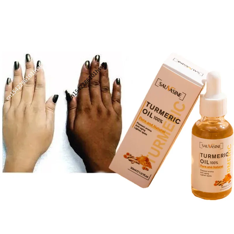 

Куркума, лимонное масло, кожа, светится, осветляет, акне, темные патчи, корректор для светлой кожи, отбеливающая Сыворотка для лица