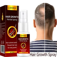 ginger hair growth products fast growing prevent hair loss hair spray serum scalp treatment activates hair follicle promote hair
