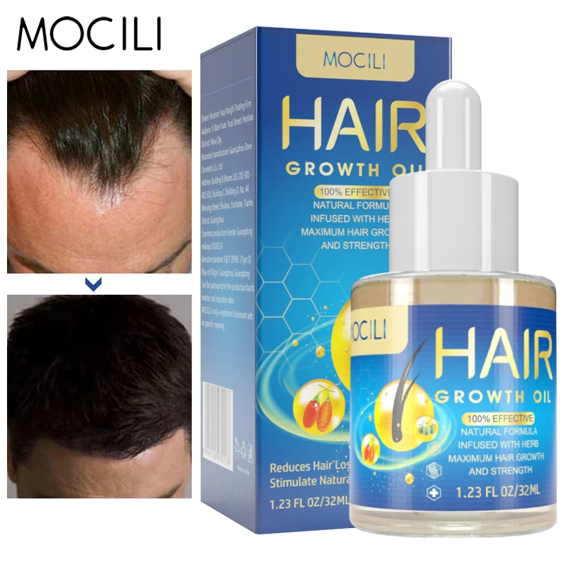 

Hair Growth Oil Improve Hair Loss Scalp Treatment Nourishes Health Care Beauty Prevent Hair Thinning Dry Frizzy Repair 32ml