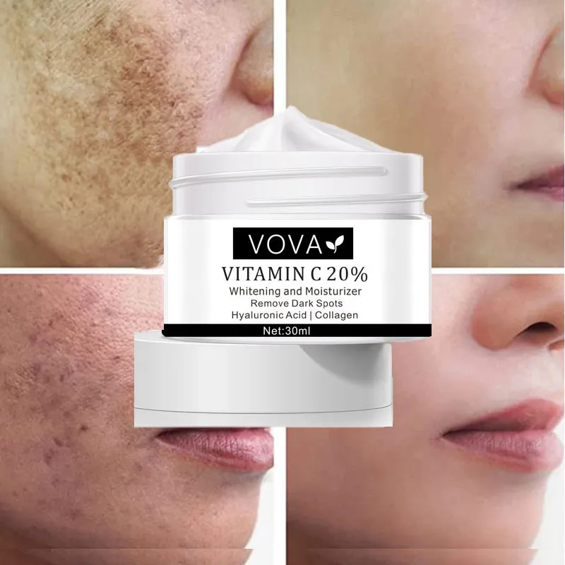 

Whitening Cream Remove Melanin Pigmentation Acne Scars Private Bleach Brighten Anti-Aging Whitening Moisturiz Body Skin Care 30g