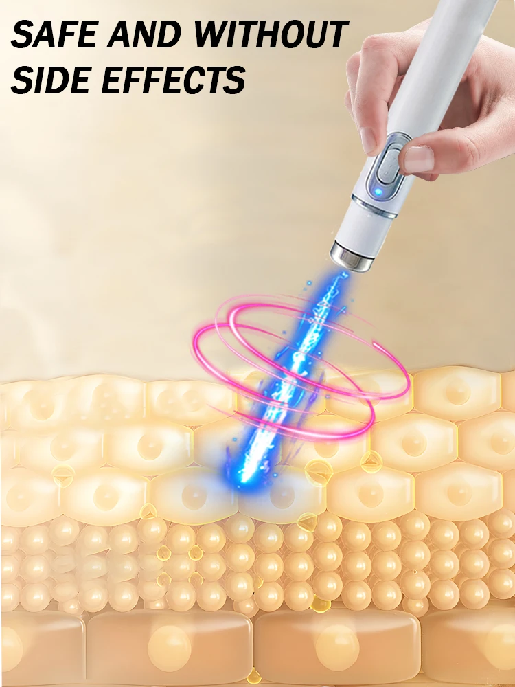 Лазерный продукт для решения проблем шрамов