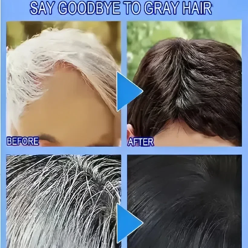 Tueur de cheveux blanks élimine les en 7 власти и ресторанный цвет натуральный девел
