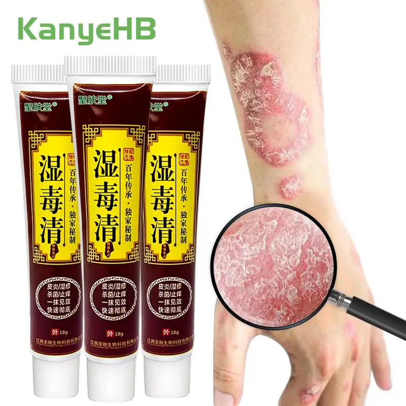 

3Pcs Herbal Psoriasis Cream Skin Care Chinese Medicine Antibacterial Eczema Dermatitis Rash Tinea Pedis Ointment Anti-Itch A339