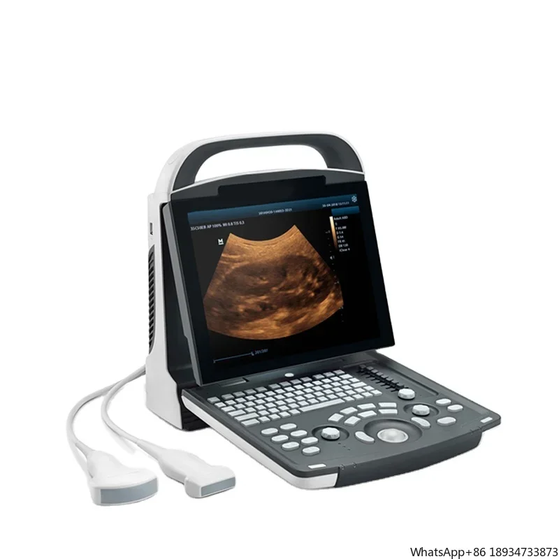 Ультразвуковой аппарат Mindray DP 10 портативный ультразвуковой сканер DP-10 для