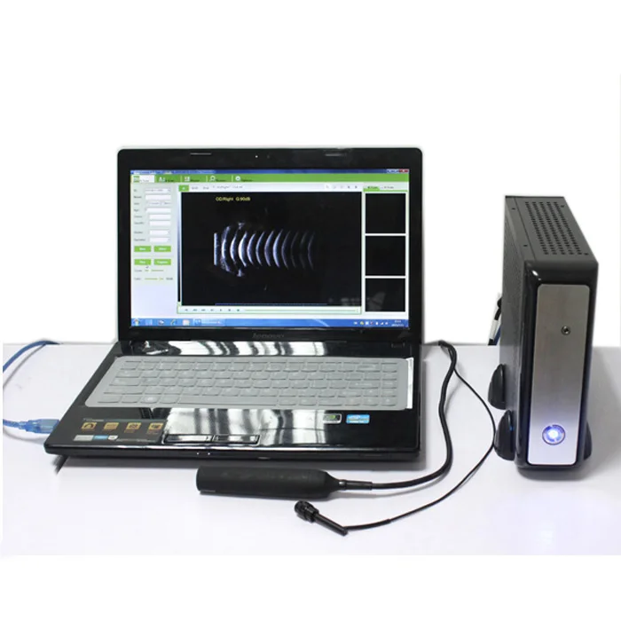 

CAS-2000B+ china top quality china ophthalmic ab scan