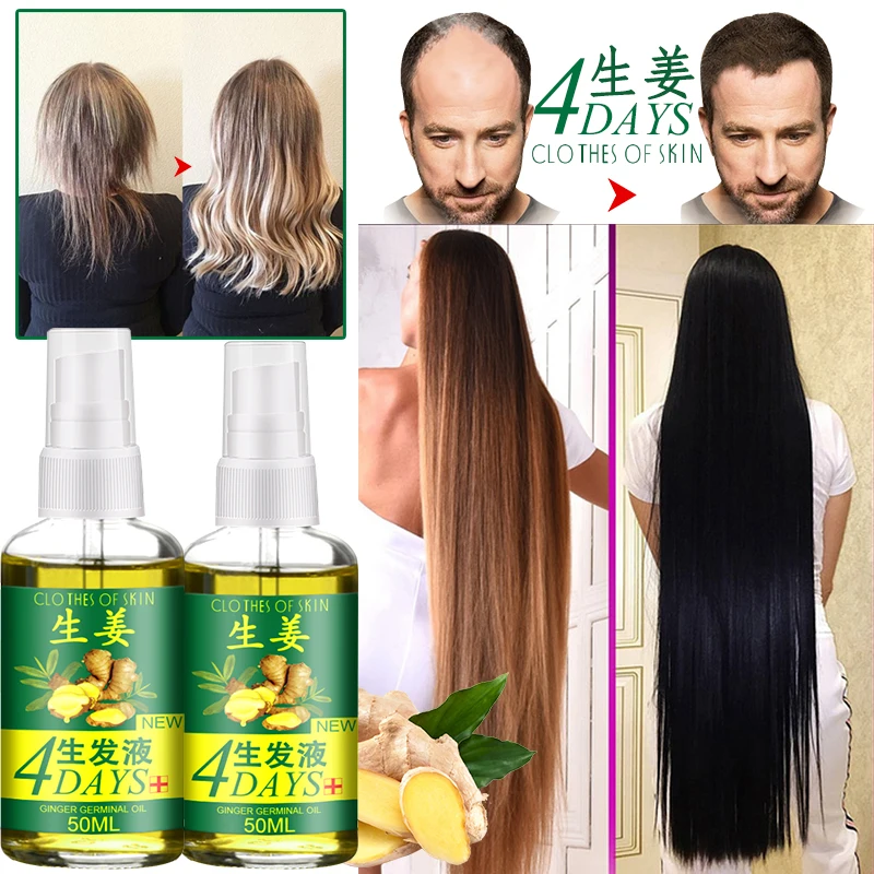 Rapid Hair Growth Essence Hair Loss Treatment Fluid Hair Growth Natural Ginger Essence Spray 50/30/20/10ml