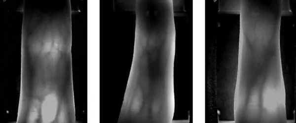 HFSecurity заводская цена бесплатное устройство для просмотра венозных сосудистых