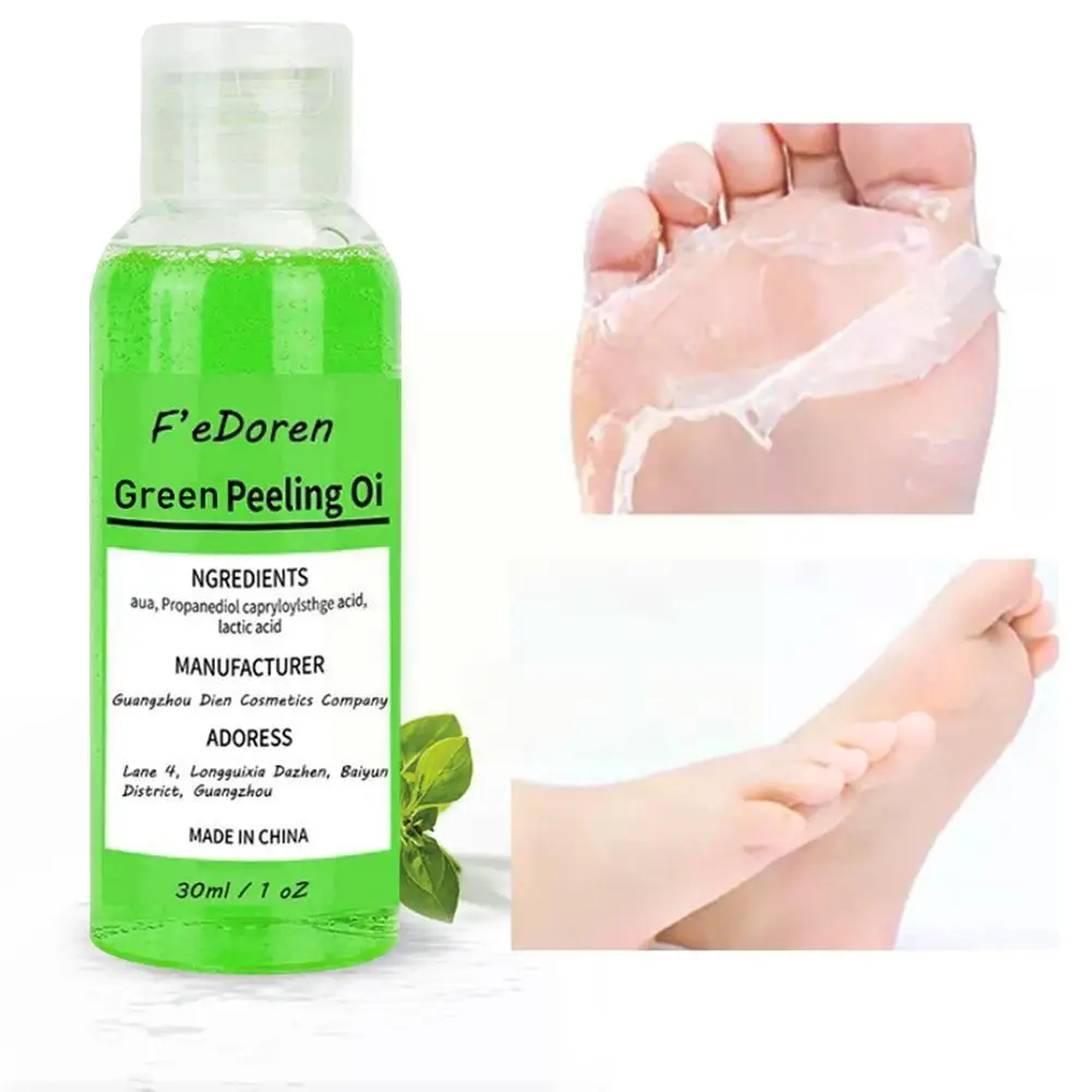 

Thai Face Yellow Peeling Oil Green Bleaching Dark Skin Retinol Blackheads Blemishes With Spots Spot Bad Skin Peptide Treatm H3D7