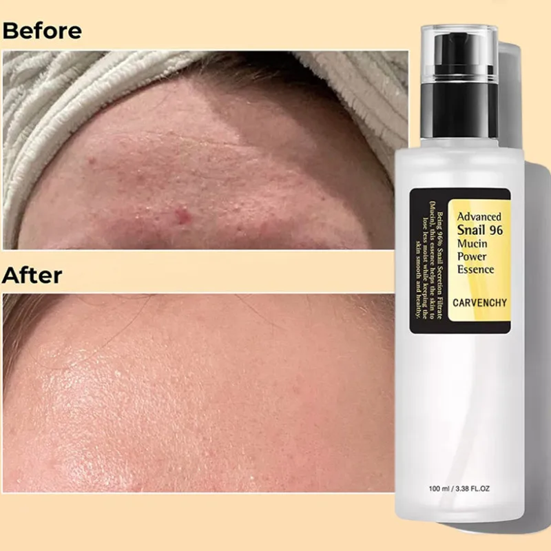

Snail Mucin 96% Power Repairing Essence,Hydrating Face Serum Shrink Pores Acne Treatment Dark Spots Fine Lines,Facial Skin Care