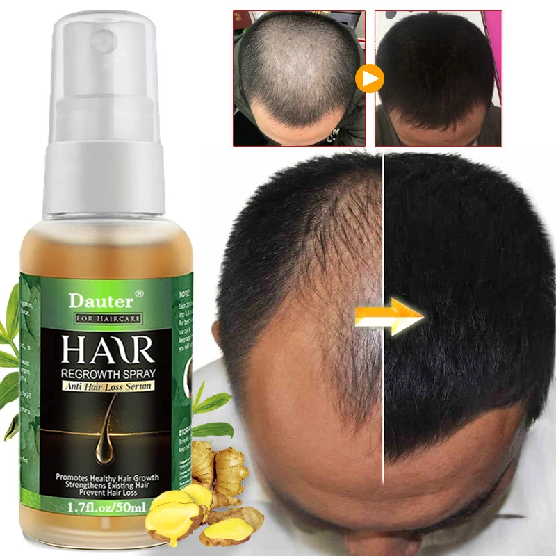 

Hair Growth Hair Care Spray Natural Hair Loss Treatment for Hair Grows Fast Hair Repair Health Care Beauty Dense Hair Growth