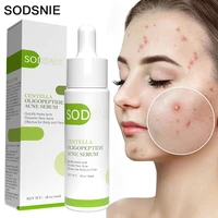 acne serum moisturizing oil control deep nourishment powerful repair eliminate inflammation remove acne scars blackheads 30ml