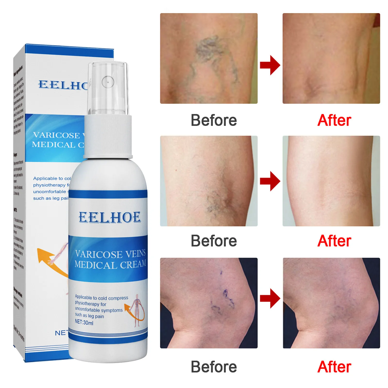 Спрей для массажа вен 30 мл |