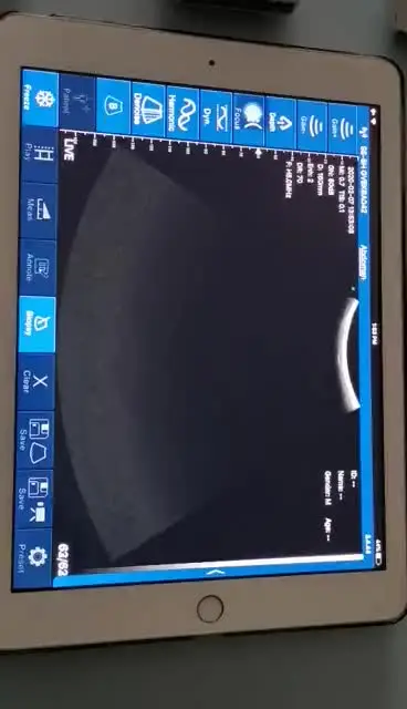 

iphone ultrasonic probe Color wireless portable WIFI ultrasound scanner